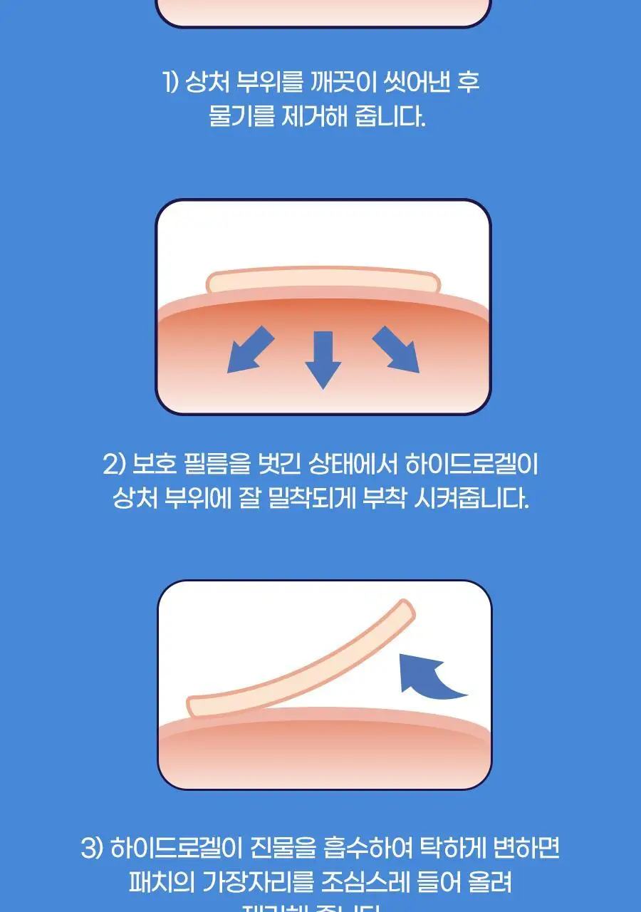 [물린 상처 보호&긁음 방지]케어플러스 이치 스팟 커버 패치 36매 상세페이지 12